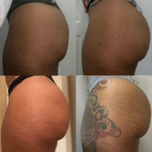 Load image into Gallery viewer, Customized Body Snatch Package