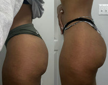 Load image into Gallery viewer, Customized Body Snatch Package